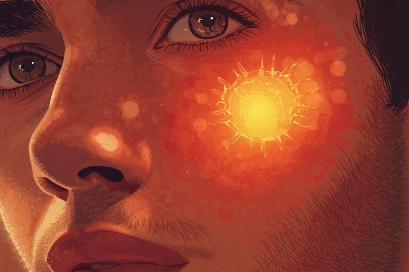 Estudio revela cómo una quemadura solar puede iniciar el cáncer