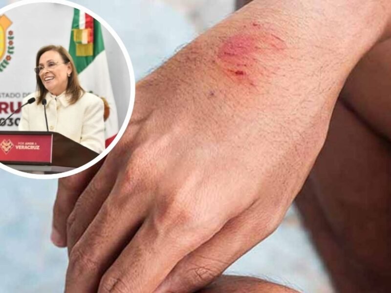 Gobernadora aclara que no hay nuevos casos de rabia en Veracruz